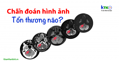 Nhiễu ảnh trên phim chụp cộng hưởng từ - Artifacts.